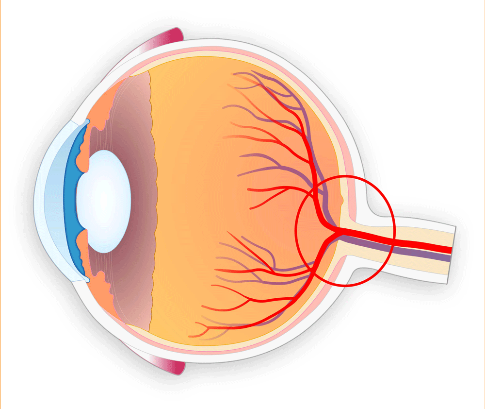 Der Sehnervenkopf auch Papille genannt befindet sich auf der Rückseite des Augeninneres und ist ein Ausgang im Auge auf der Netzhaut. Die Sehnerven verlassen an dieser Stelle das Auge. Dieser Punkt muss frei sein und die Durchblutung muss funktionieren. Für die Untersuchung des Grünen Stars, Glaukom ist diese Stelle wichtig.