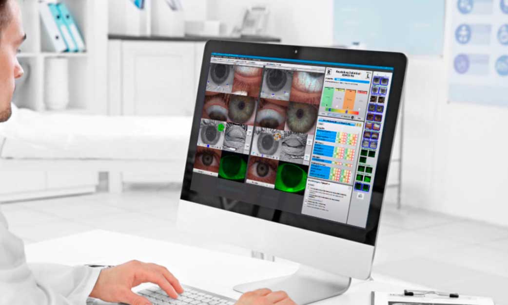 1a Auszeichnung für Augenuntersuchung in Ingolstadt bei Optik Schönauer. Screening der Cornea, Tränenfilmuntersuchung mit dem Oculus Keratograf